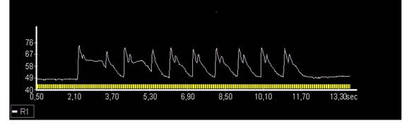 D:\������\ISO\APELINE_myocytes\Cell#111 HF-Control.jpg
