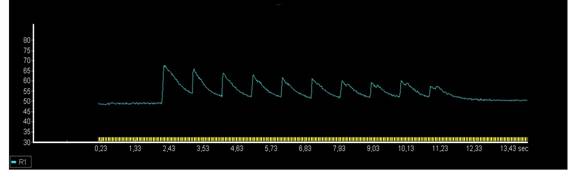 D:\������\ISO\APELINE_myocytes\cell#108 HF-Control.jpg