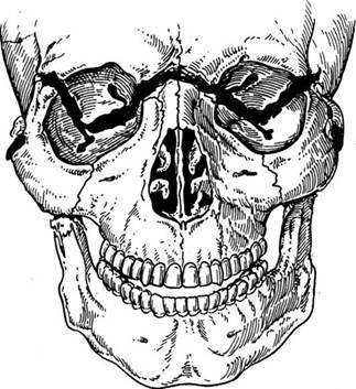 http://vmede.org/sait/content/Travmatologiya_4lx_afan_2010/6_files/mb4.jpeg