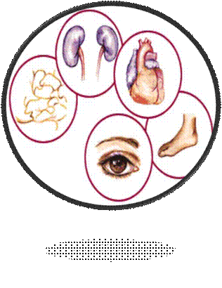 http://www.webdiabet.ru/wp-content/uploads/2013/11/complications-diabetes.jpg