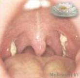 http://foto.medicaterra.by/foto/1237844356_s.jpg