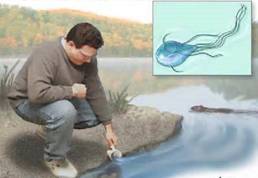 http://med36.com/files/uploads/images/ills/giardiasis.jpeg