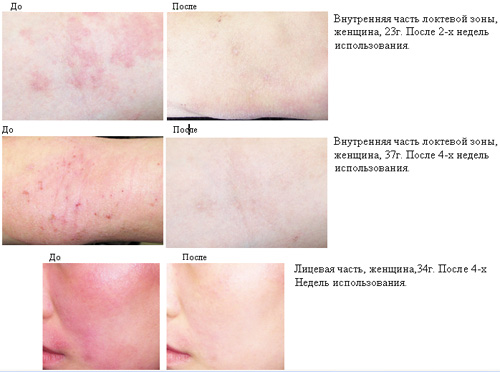 http://www.atopalm-mle.ru/img/images/ato_skin.jpg