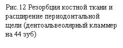 Подпись: