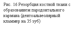 Подпись: