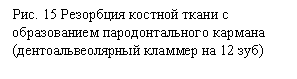 Подпись: