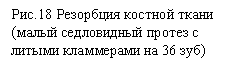 Подпись: