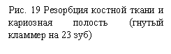 Подпись: