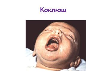 http://900igr.net/datas/meditsina/Infektsionnye-bolezni/0031-031-Kokljush.jpg