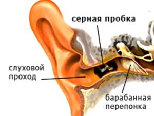 http://www.xn--80abere2d2dza.xn--p1ai/media/page_image/12650/w/uho-v-razreze.jpg