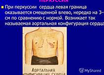 http://ts1.mm.bing.net/th?id=H.4793279235688433&w=211&h=152&c=7&rs=1&pid=1.7