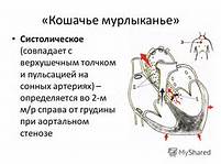 http://ts4.mm.bing.net/th?id=H.4746038929394242&w=201&h=149&c=7&rs=1&pid=1.7