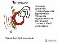 http://ts2.mm.bing.net/th?id=H.4681554272192891&w=187&h=143&c=7&rs=1&pid=1.7