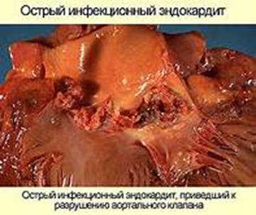 ��������: http://tse1.mm.bing.net/th?&id=OIP.M8b57c87cf4bb3c3fa88bcbd3308c8895o0&w=198&h=170&c=0&pid=1.9&rs=0&p=0