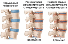 bolbehtereva