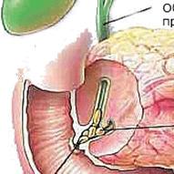 http://www.rusmedserv.com/pancreaticcancer/img/4pc.png