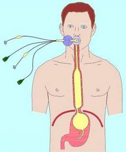 http://www.hcv.ru/articles/bliver/image/port_hyper_tamponada.jpg