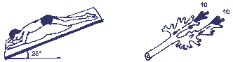 http://www.rusvrach.ru/img/data/ms-4-2004str19.gif