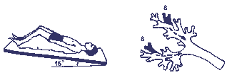 http://www.rusvrach.ru/img/data/ms-4-2004str19.gif