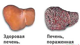 C:\Users\LI\Pictures\virusnyj-gepatit-g1.jpg