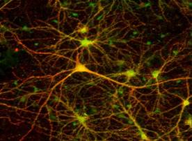 C:\Documents and Settings\Admin\������� ����\�������\2-1-neuron.jpg