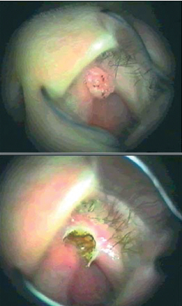 http://www.mediasphera.ru/uppic/Vestn%20Otorinolaringol/2008/4/4/k4-1.jpg