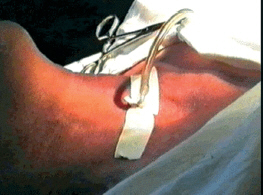 http://www.mediasphera.ru/uppic/Vestn%20Otorinolaringol/2008/4/4/k4-2.jpg