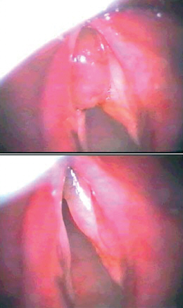 http://www.mediasphera.ru/uppic/Vestn%20Otorinolaringol/2008/4/4/k4-3.jpg