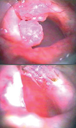 http://www.mediasphera.ru/uppic/Vestn%20Otorinolaringol/2008/4/4/k4-4.jpg