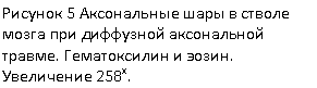 Подпись: