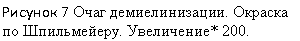 �������: