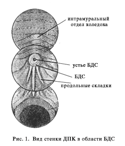 http://gastroendoscopy.ru/artpic/a31a.gif