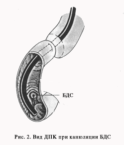 http://gastroendoscopy.ru/artpic/a31b.gif