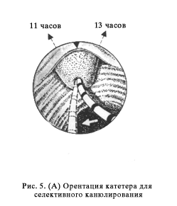 http://gastroendoscopy.ru/artpic/a31e.gif