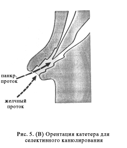 http://gastroendoscopy.ru/artpic/a31g.gif