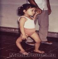 Новая вакцина уничтожит полиомиелит